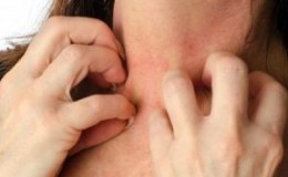 Que faire en cas d'allergie à la citrouille: traiter efficacement et prévenir à l'avance