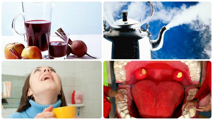 Comment utiliser les betteraves pour les maux de gorge: une recette pour se gargariser, compresses et inhalations