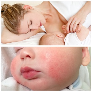 Pouvez-vous manger des pommes de terre pendant l'allaitement?