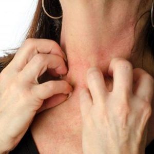 Que faire des allergies à la citrouille: traiter efficacement et prévenir à l'avance