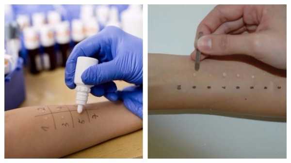 Que faire des allergies à la citrouille: traiter efficacement et prévenir à l'avance