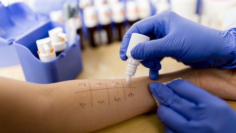 Comment l'allergie aux pommes de terre se manifeste-t-elle chez les enfants et les adultes