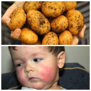 Traiter les questions de savoir pourquoi l'enfant mange des pommes de terre crues et est-ce nocif