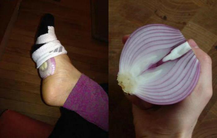 Utiliser des oignons dans des chaussettes à des fins médicinales